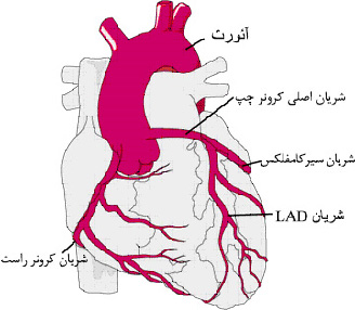 گرفتگی رگ قلب